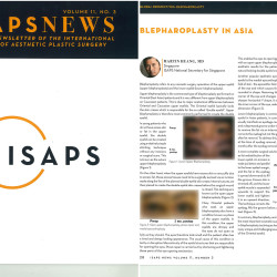 MH Plastic Surgery ISAP News Blepharoplasty in Asia MH Plastic Surgery ISAP News Blepharoplasty in Asia